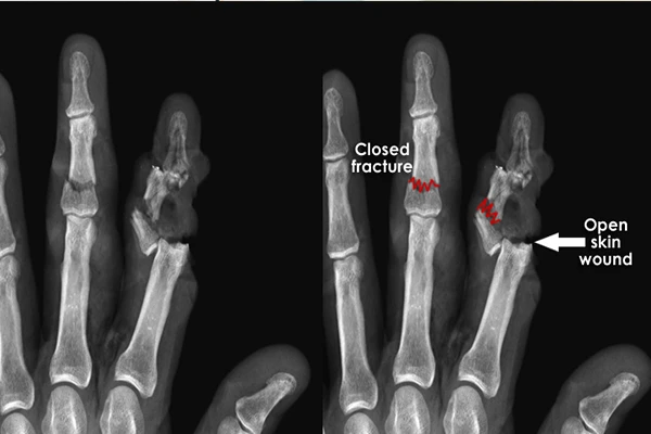 A trauma bay or a multi-injury CT scan