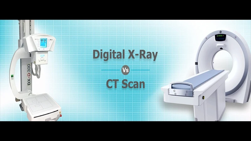 A diagram comparing a simple X-ray setup to a rotating CT gantry.